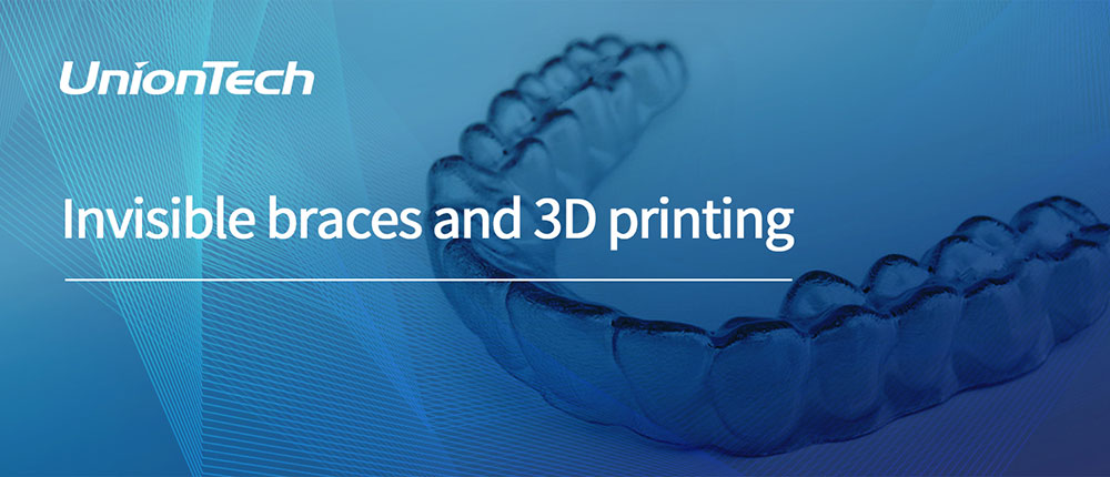 Invisible Braces and 3D Printing