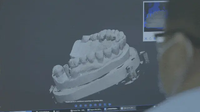 3D_printing_oral_model_(2).png.webp