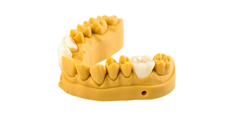 restoration_models_uniontech.png.webp