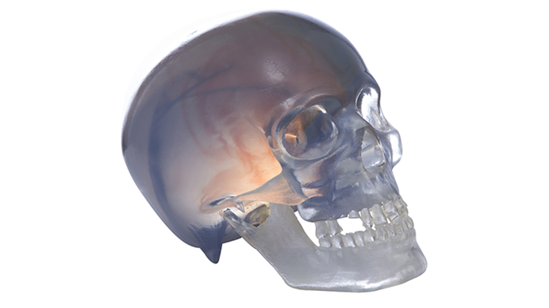 3D_printed_head_and_jugular_arteriovenous_scanning_pathology_map.png