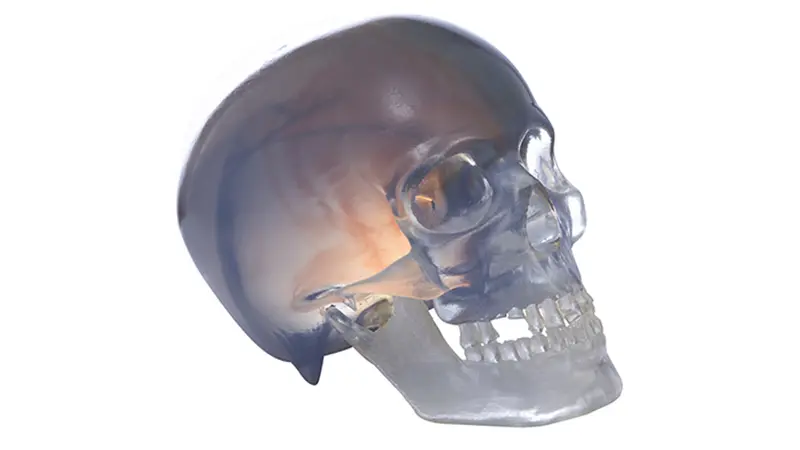 3D_printed_head_and_jugular_arteriovenous_scanning_pathology_map.png.webp 3D_printed_head_and_jugular_arteriovenous_scanning_pathology_map.png.webp