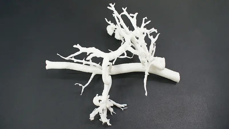 Blood_Vessel_Model.jpg.webp Blood_Vessel_Model.jpg.webp