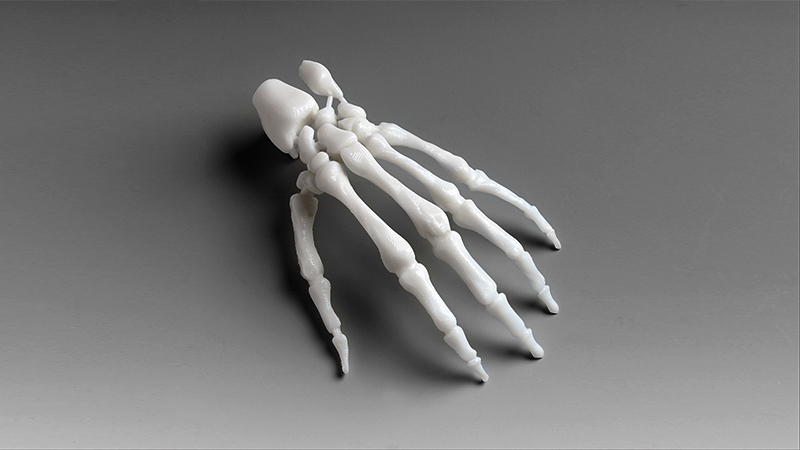 Orthopedics_Hand_Skeleton.jpg