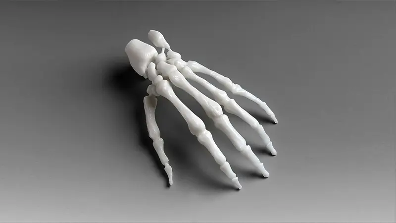 Orthopedics_Hand_Skeleton.jpg.webp Orthopedics_Hand_Skeleton.jpg.webp