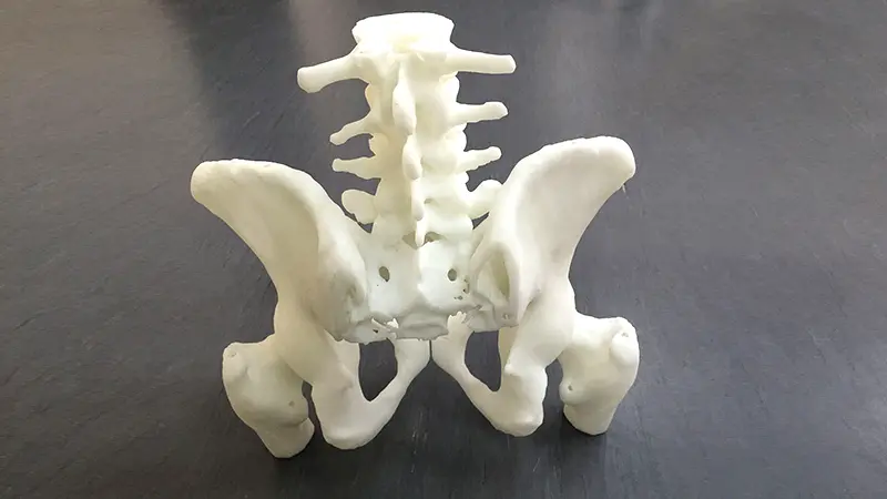 Orthopedics_Hip_Bone.jpg.webp Orthopedics_Hip_Bone.jpg.webp