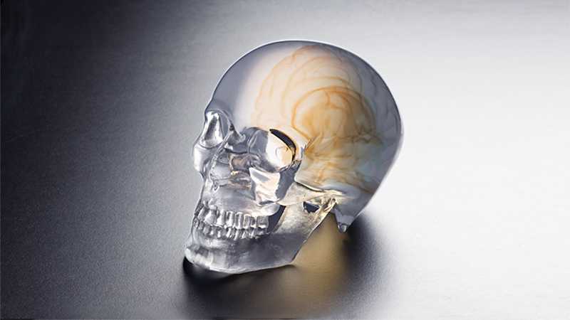 Orthopedics_Skull_Model.jpg