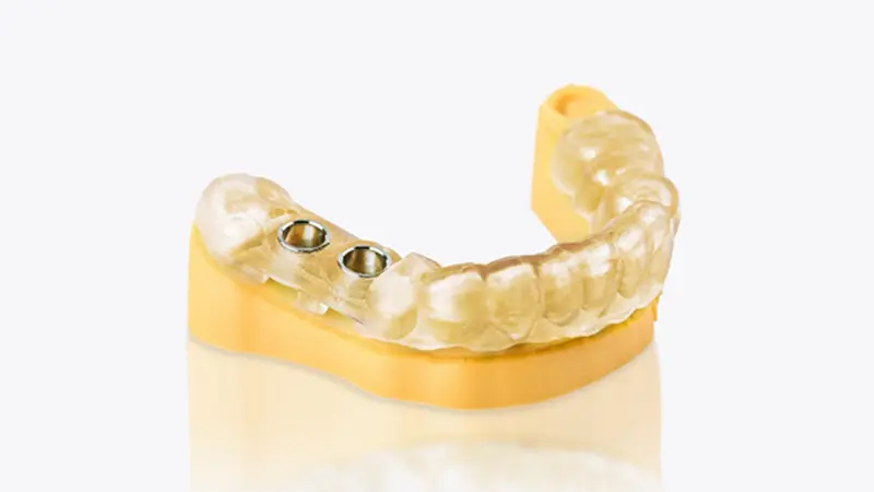 uniontech_dental_implant_guide.png.webp uniontech_dental_implant_guide.png.webp