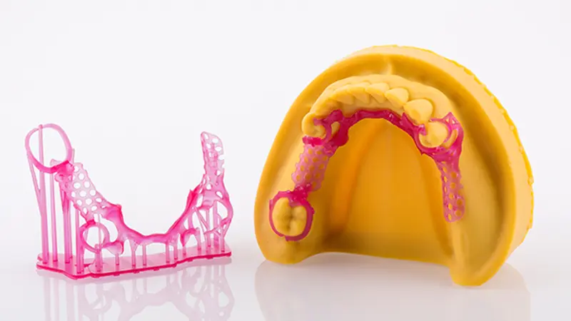 uniontech_oral_wax-up.png.webp uniontech_oral_wax-up.png.webp