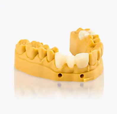 Model v2.0